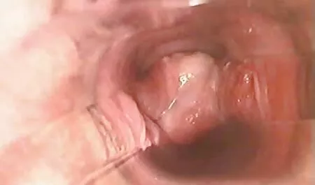Pavel, a classic tits young girl softcore